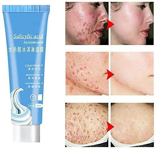 Face pimple(Acne) removal annd skin whitening ice cream 120ml